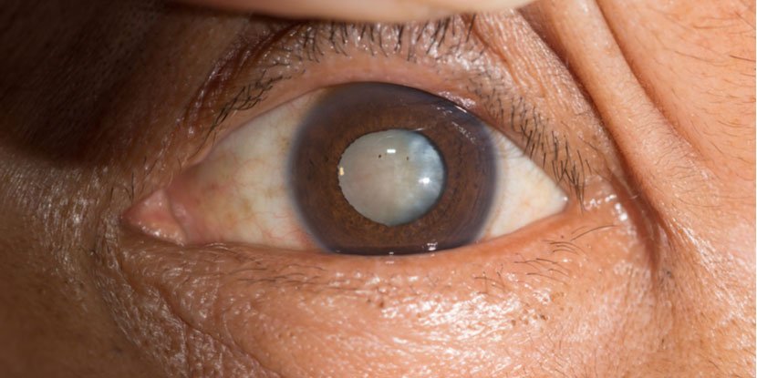 Eye care consultation
